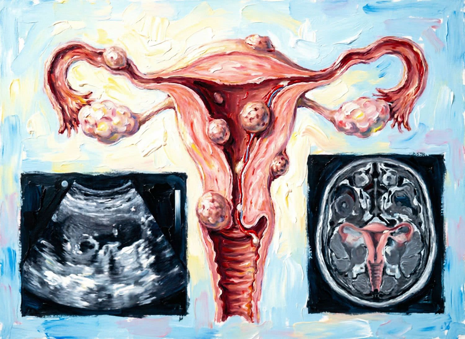 Ilustracja poglądowa Ginekologia i Położnictwo - Zdrowie i Medycyna